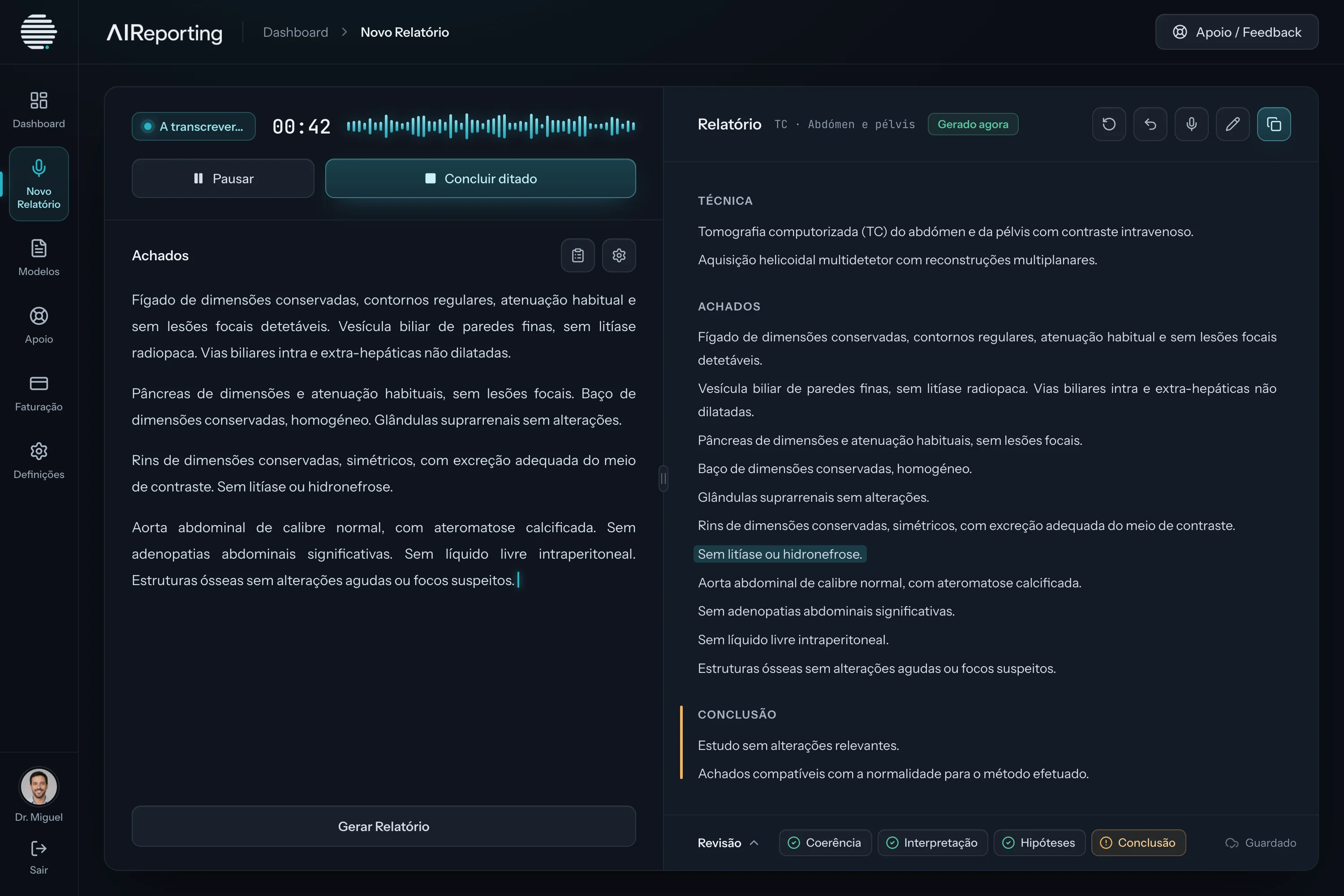 O relatório concluído, com os achados positivos destacados e os quatro indicadores da revisão por baixo.